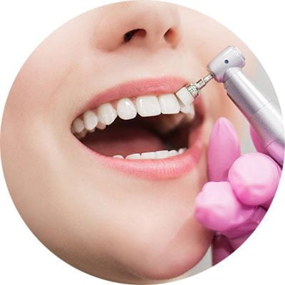 cosmetic dentist doing teeth whitening